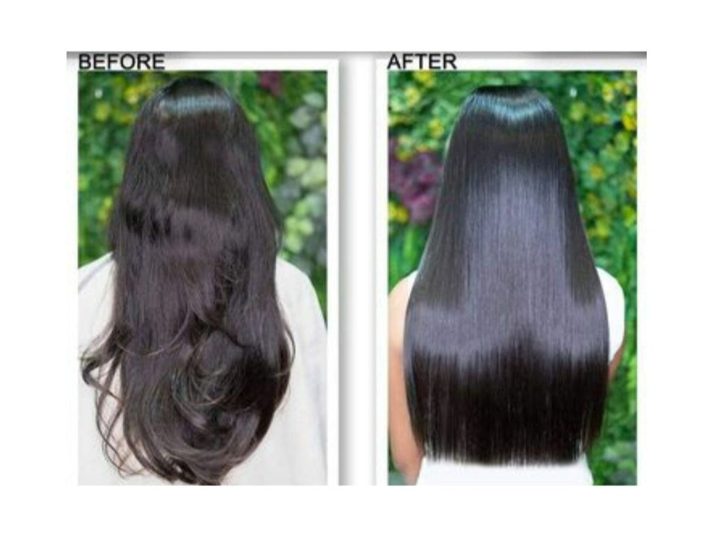 Hair Pro Care Anti-Dandruff Tea Tree Shampoo & Conditioner Sulphate Free 300ml