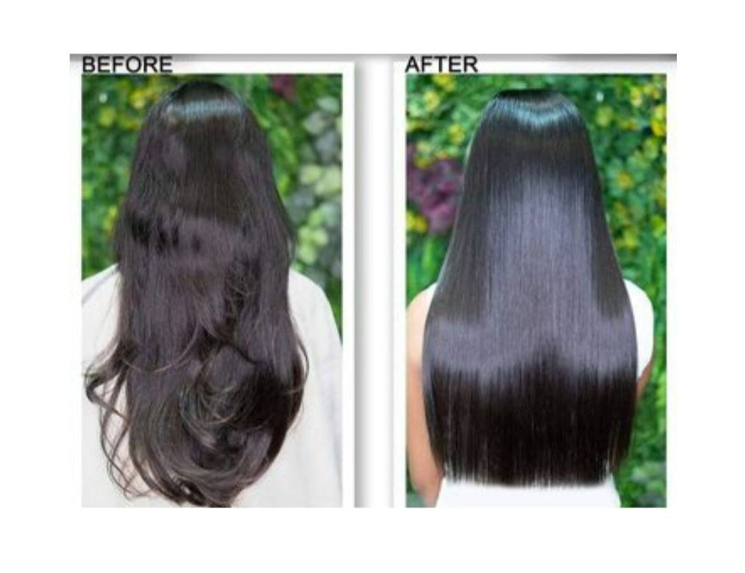 Hair Pro Care Anti-Dandruff Tea Tree Shampoo & Conditioner Sulphate Free 300ml